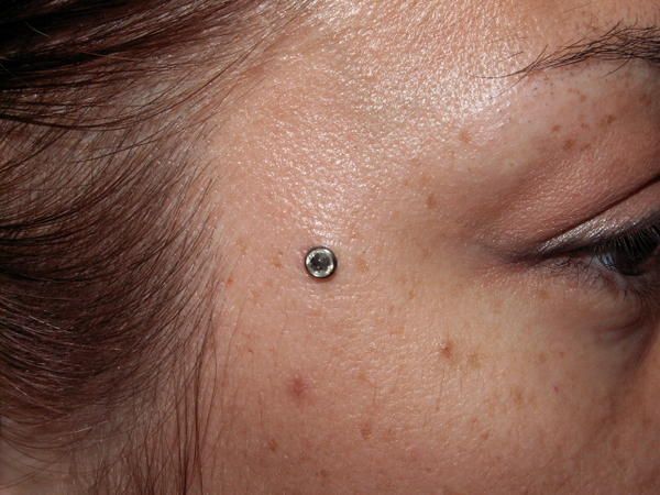 bijoux microdermal implant !!! Le blog de jim piercing