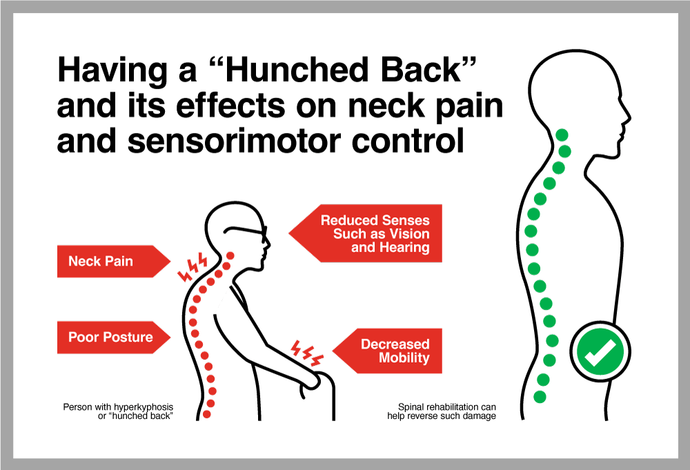 Having a “Hunched Back” and its effects on neck pain and sensorimotor