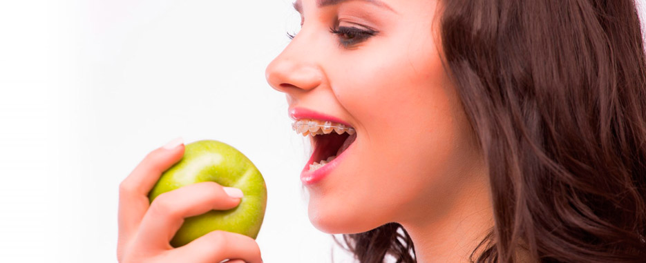 ¿Por qué se despegan los brackets? Infórmate aquí