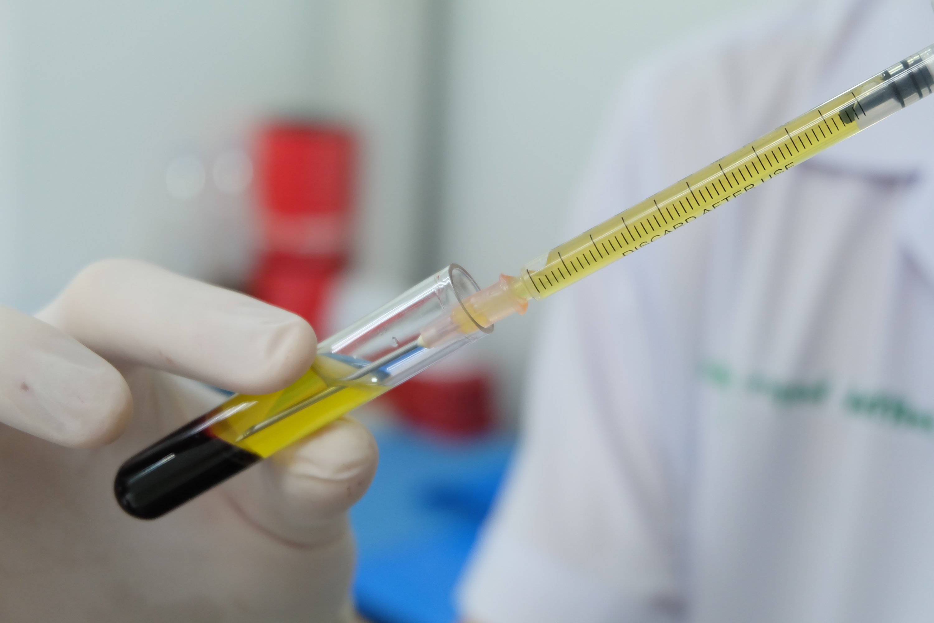 What is blood plasma, how to donate it and why it's so essential