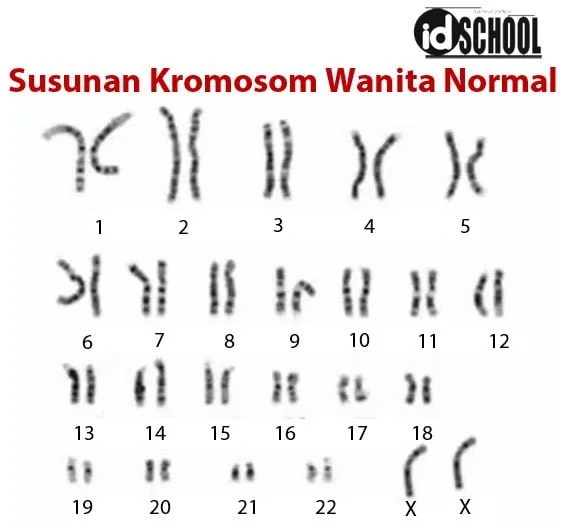 Gambar Kromosom Manusia analisis