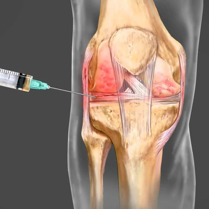 Prolotherapy Integrative Family Medicine of CT