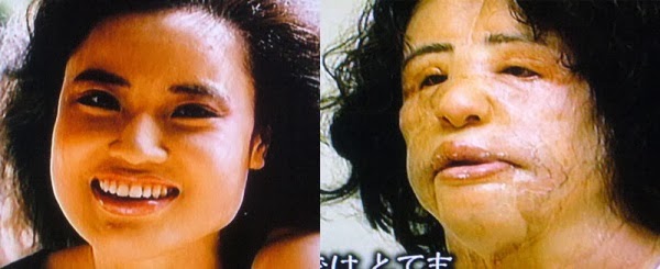 Di Sebalik Keayuan Gadis Korea Jalani Pembedahan Plastik