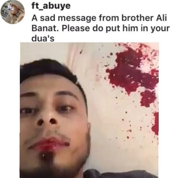 Video of a Rich Man, Ali Banat, Who Is In His Last Stage of Cancer Goes