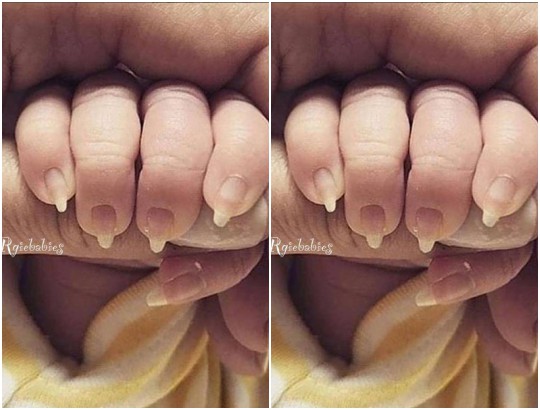 Viral photo of baby born with long nails AknMedia