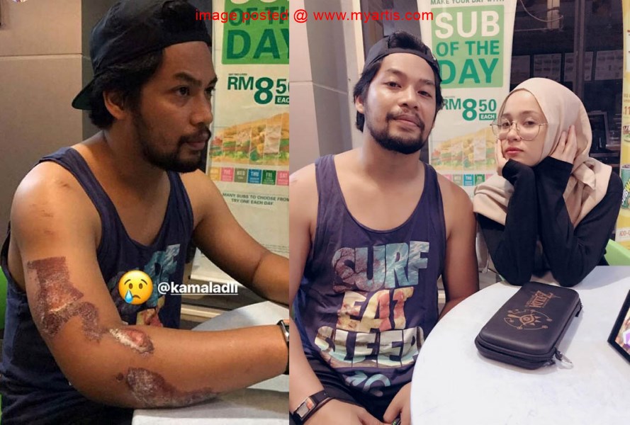 Cerita Artis Malaysia LORI LANGGAR LARI KAMAL ADLI SYUKUR TAK CEDERA