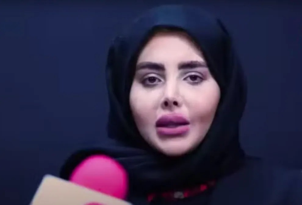 'Zombie' Angelina Jolie Lookalike Shows Off Her Real Face