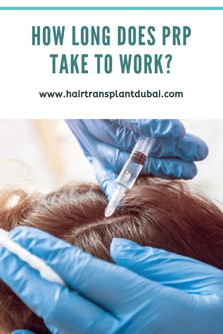 How Long Does PRP Take To Work? Hair Transplant Dubai How Long Does PRP Take To Work? Hair Transplant Dubai