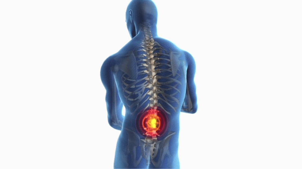 Common Back Injuries and How to Treat Them iKreate Passions