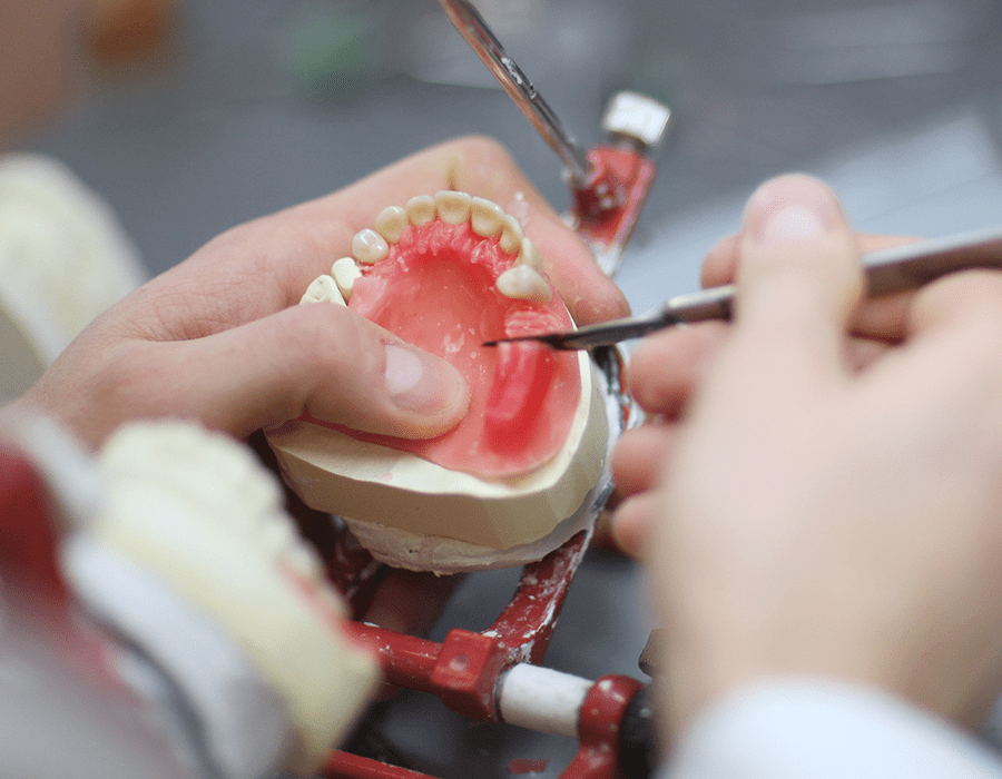 Reparación de prótesis Xpress en 2 horas, ¡porque la boca no espera