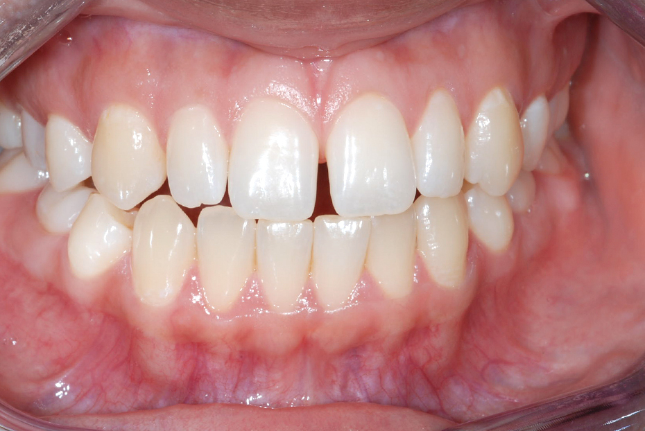 Other Treatments ILFORD Dental Centre