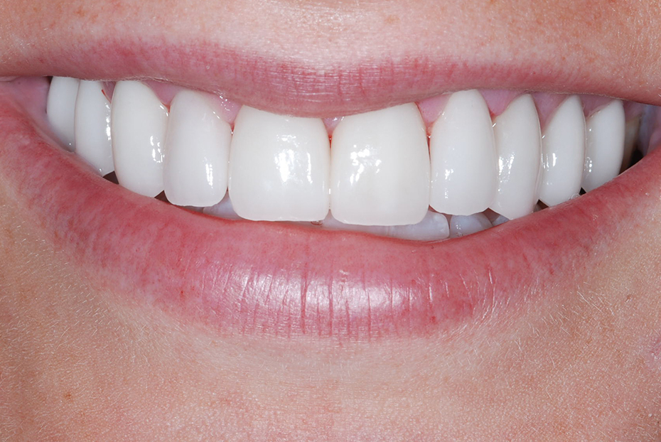 Other Treatments ILFORD Dental Centre