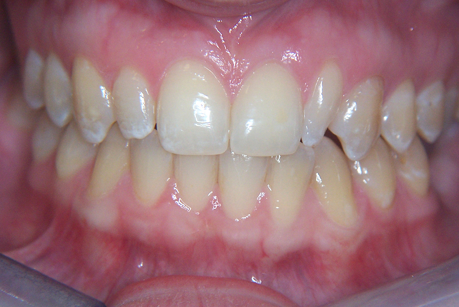 Other Treatments ILFORD Dental Centre