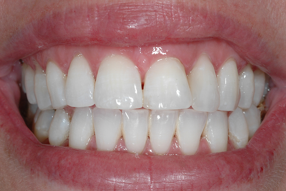 Other Treatments ILFORD Dental Centre