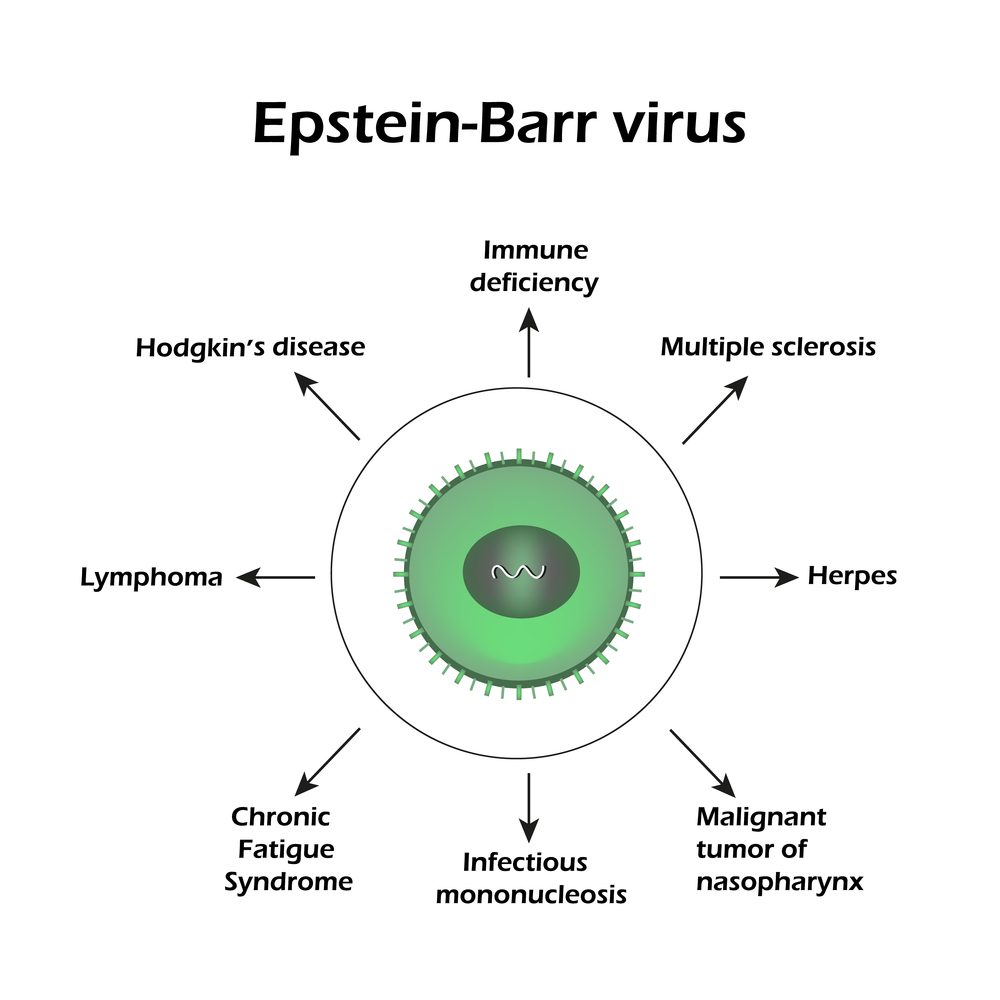 EBV Antibody Test Overview, Causes, Symptoms, Treatment