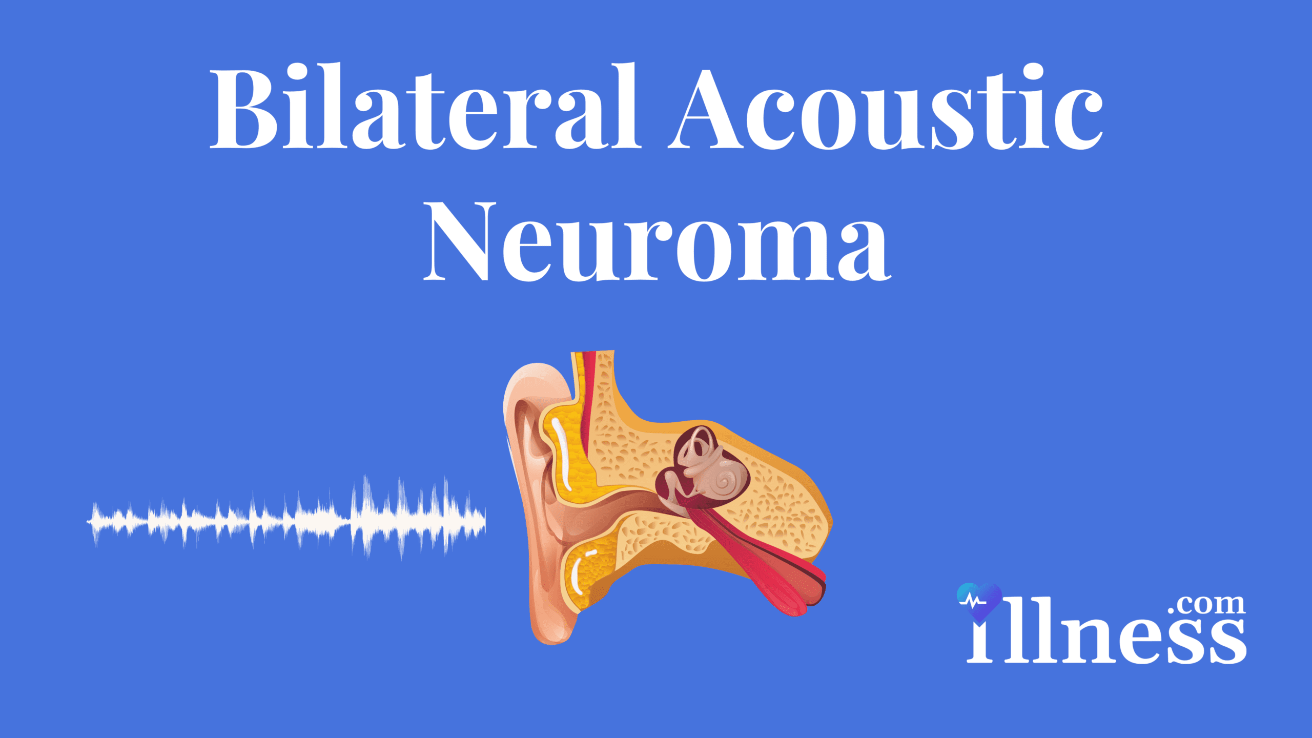 Acoustic Neuroma