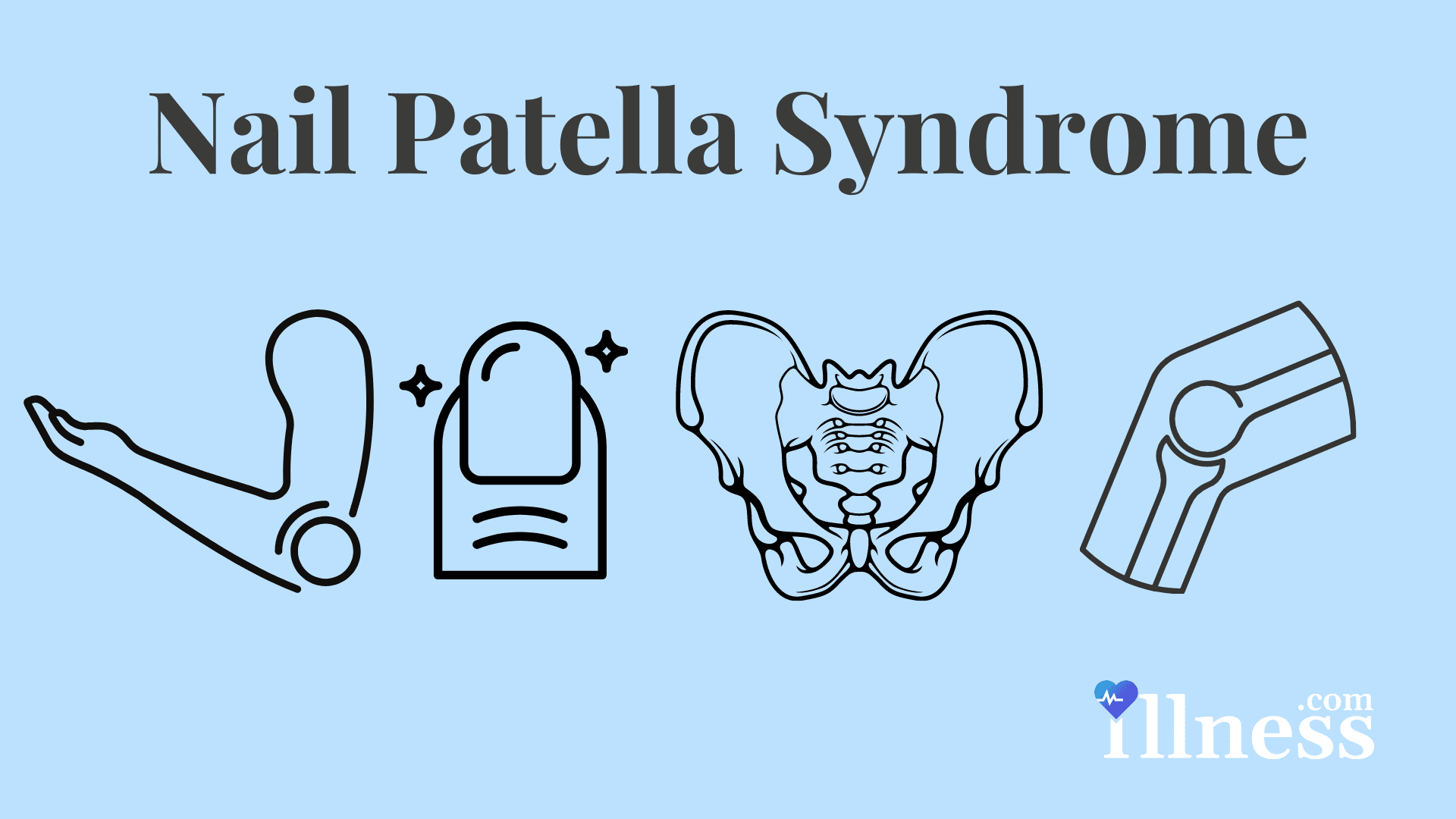 Nail Patella Syndrome Overview, Causes, Symptoms, Treatment