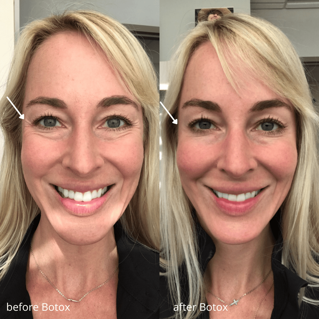 Botox Illume Cosmetic Surgery & MedSpa