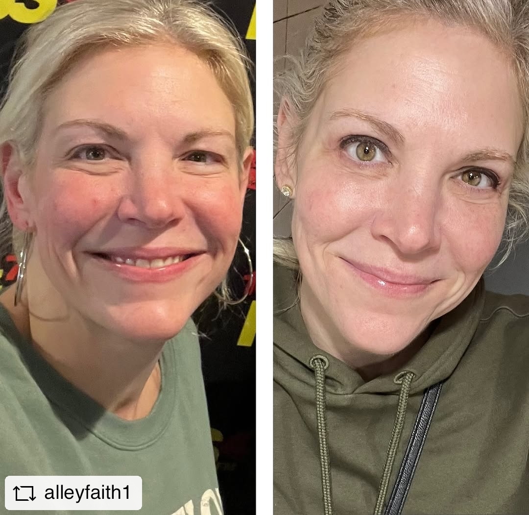 Alley Faith and Illume Illume Cosmetic Surgery & MedSpa