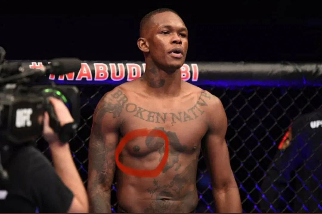 Why Did Israel Adesanya's Pectoral Muscle Get Swollen Up in his Last