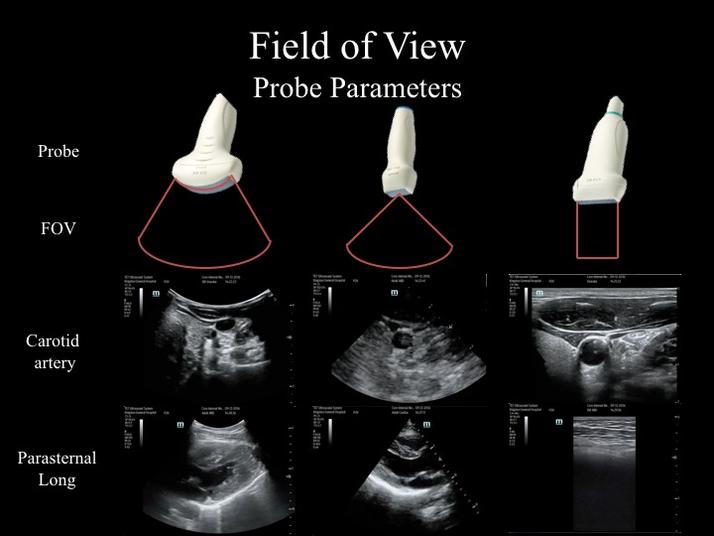 Internal Medicine Point of Care Ultrasound IMPoCUS