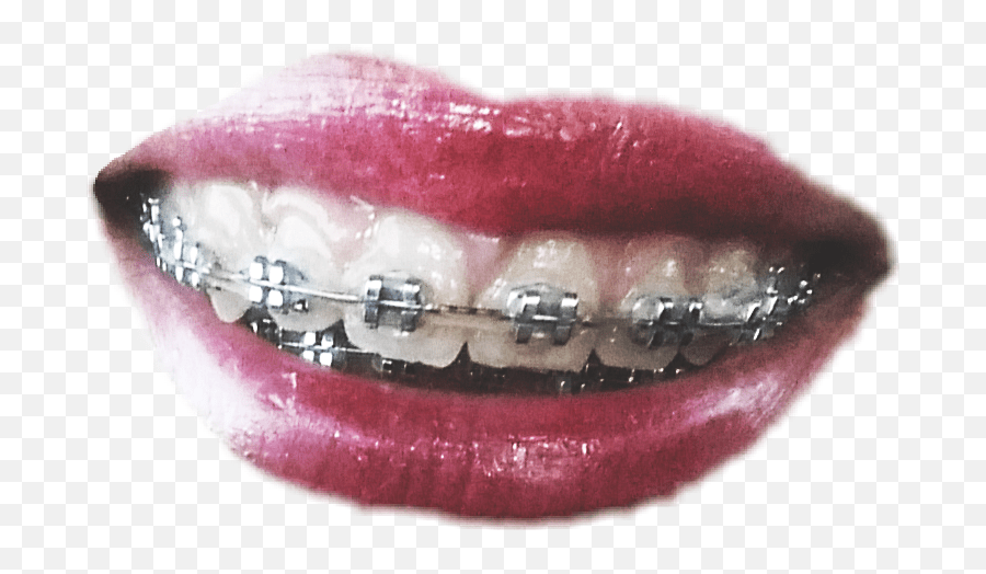Trending Canine Tooth Emoji,Brace Face Emoji free transparent emoji