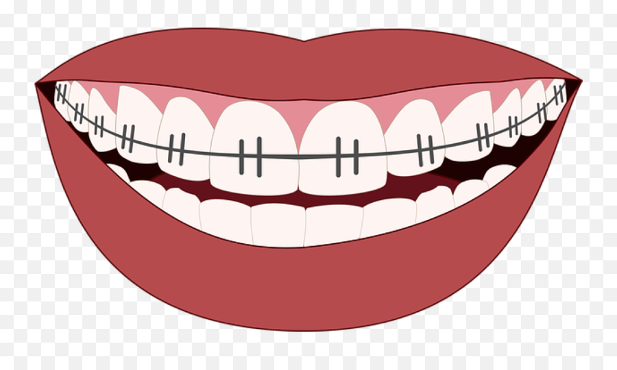 Clipart Smile Brace Transparent Cartoon Mouth With Braces Emoji,Brace