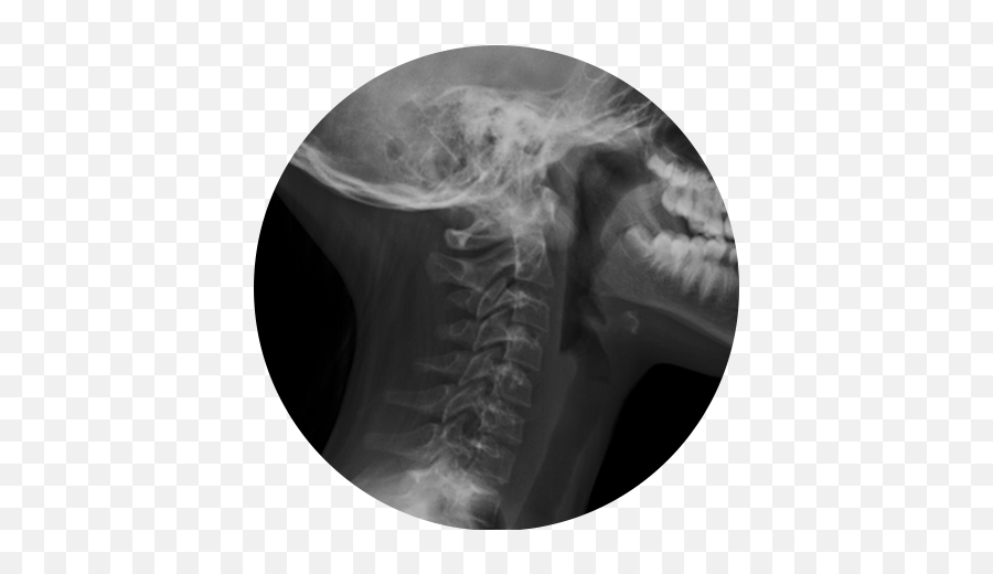 Xray Heart Transparent Png Clipart Radiology Transparent Emoji,X Ray