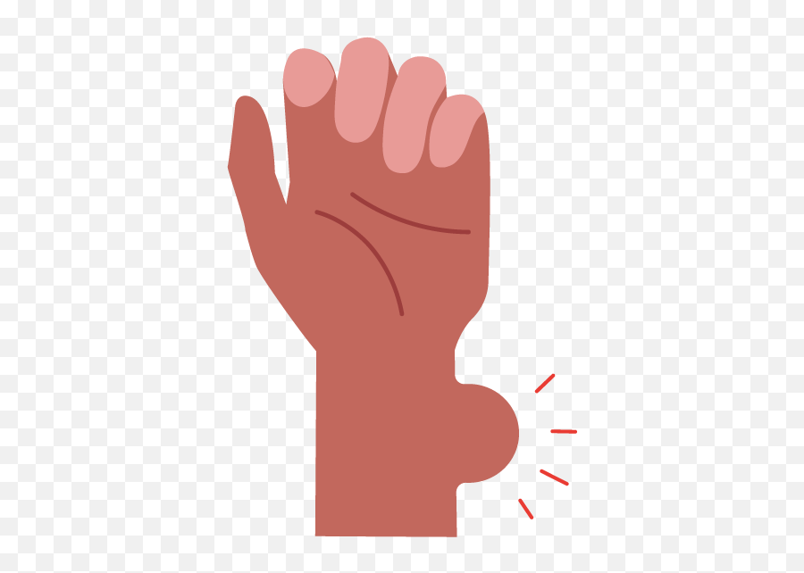 Swollen Wrist What Does Wrist Swelling Mean Buoy Swollen Wrist Emoji