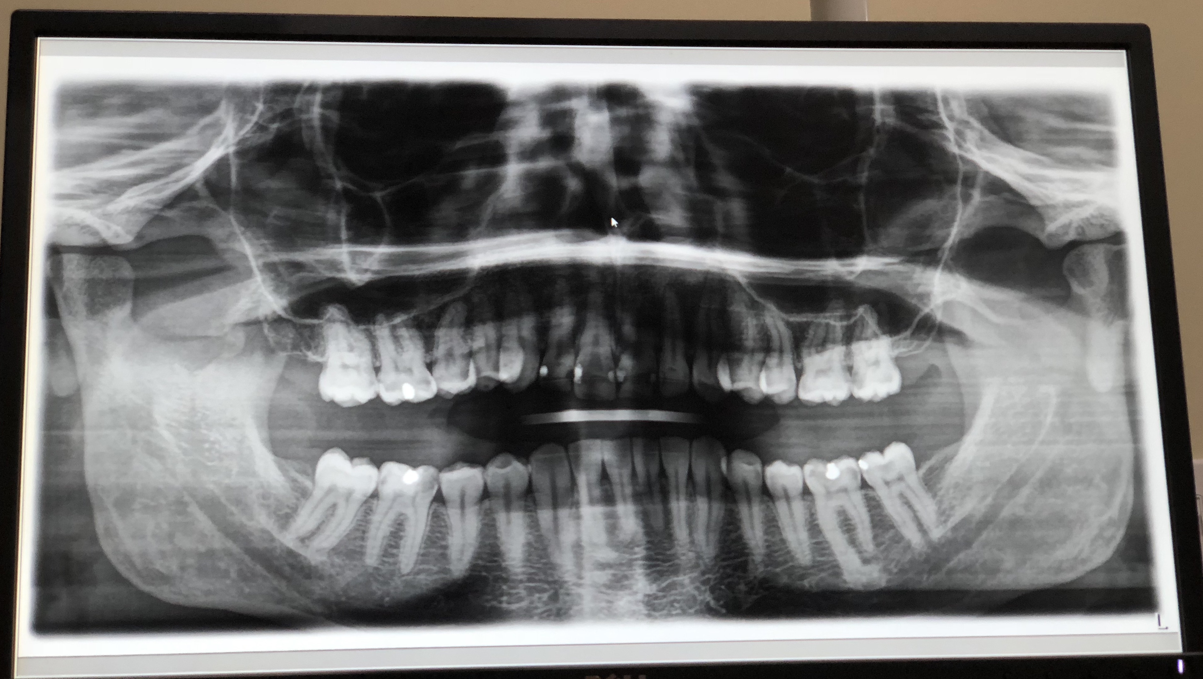 Haven't Been To Dentist in 10 years... Advice Appreciated. Dental