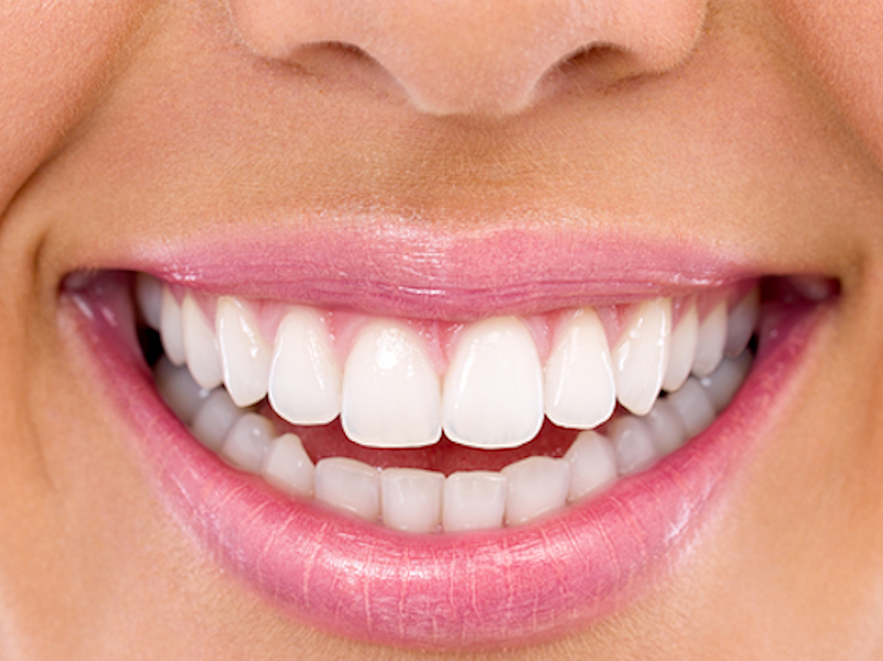 Professional Teeth Whitening General and Cosmetic Dentistry Premier Dental & Oral Health Group