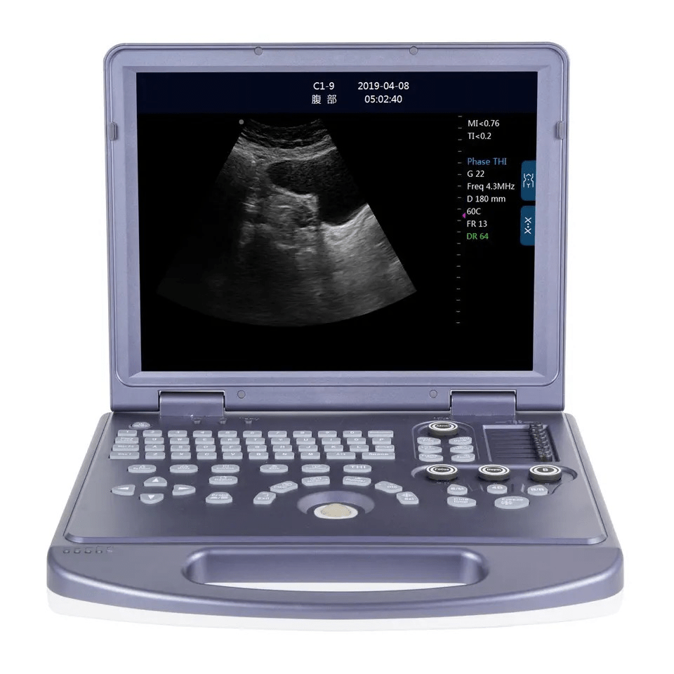 2D Portable Ultrasound Machine Price with Doppler Instruments China Ultrasound and Portable