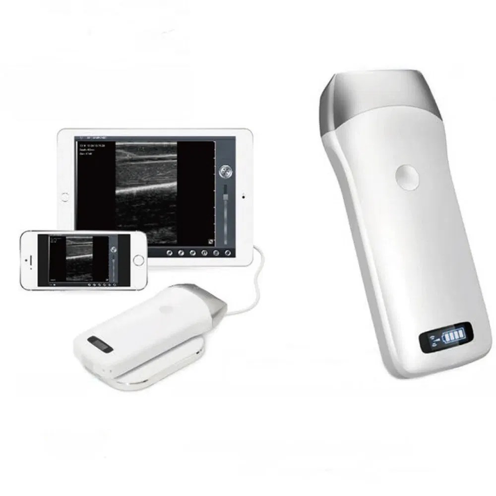 Cheapest USB Micro Handheld Color Doppler Ultrasound System / Machine