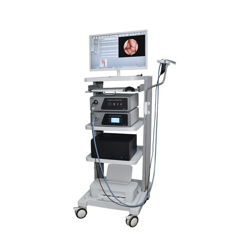 Diagnostic Laryngoscopy Video Endoscope Camera System Medical Endoscopy