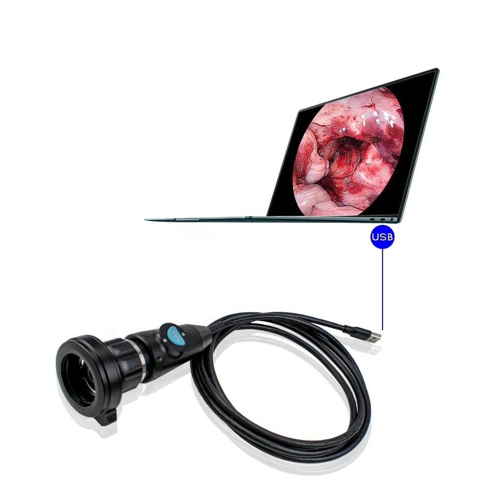ICEN Ent Endoscopy Camera Handle Veterinary Endoscope Portable Rigid Endoscopy Camera For