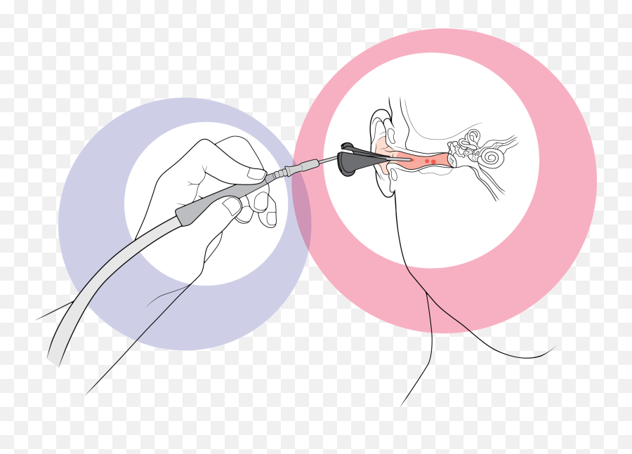 To Waurn Ponds Hearing Clinic Ear Wax Removal Geelong Ear