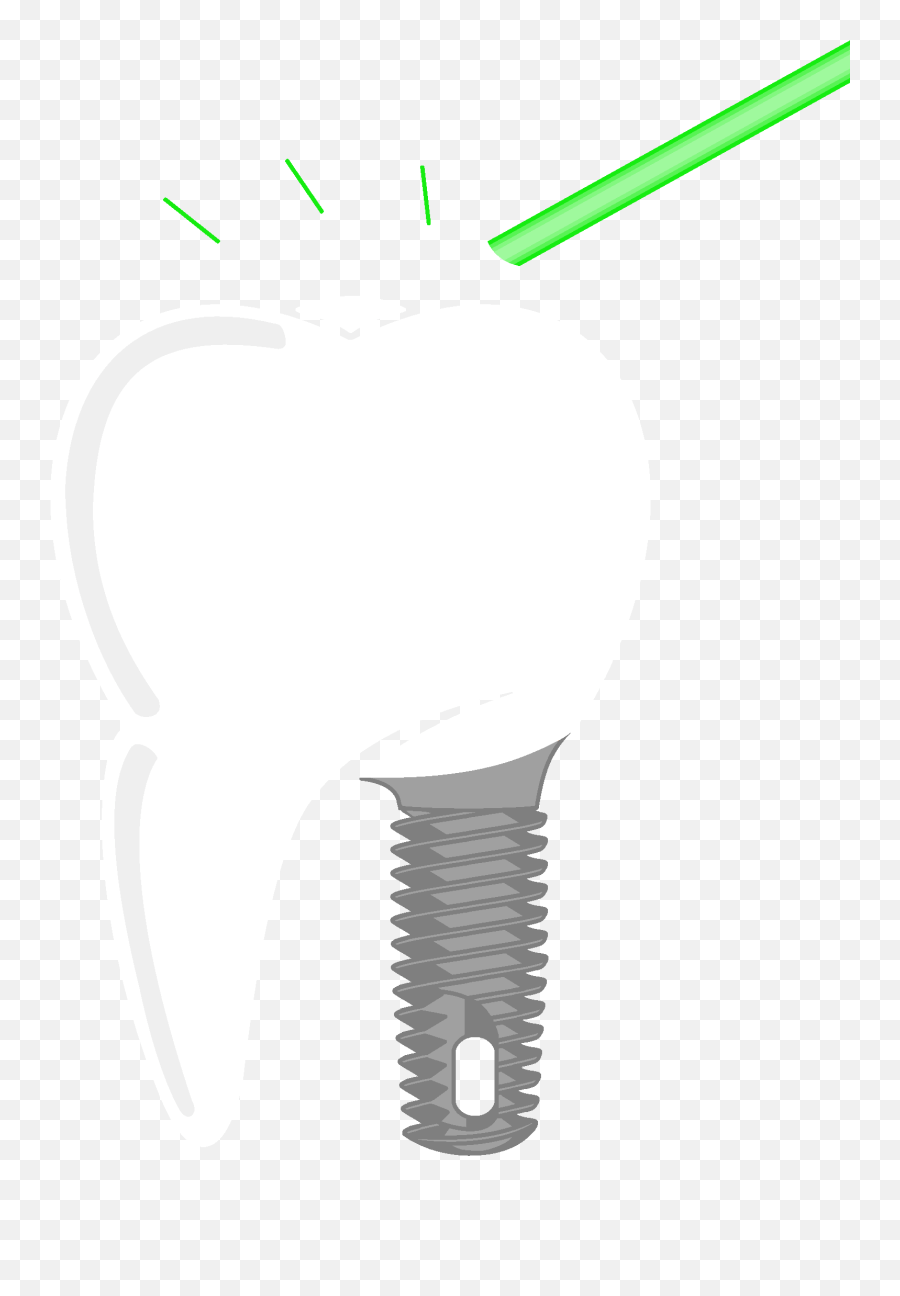 Wahpeton Nd Dentist In Fargo Clip Art Png,Tooth Transparent