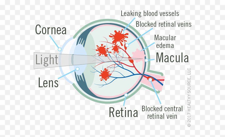 Eye Shows Cornea Lens Macula Blood Supply To Macula Png,Lens Flare