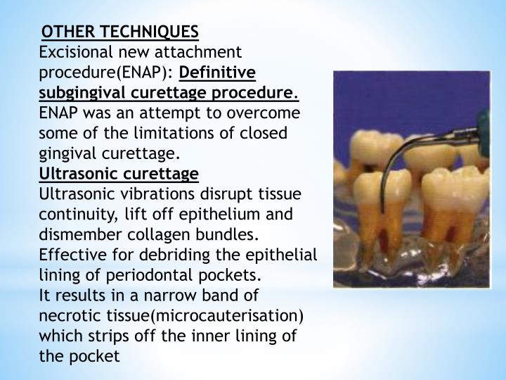 PPT Surgical Periodontal Therapy PowerPoint Presentation ID1016139