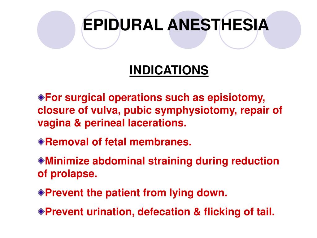 PPT EPIDURAL ANESTHESIA PowerPoint Presentation, free download ID
