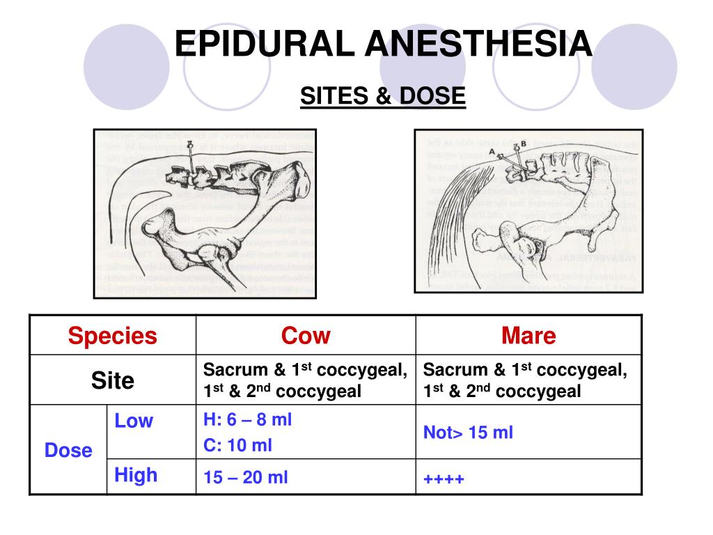 PPT EPIDURAL ANESTHESIA PowerPoint Presentation, free download ID