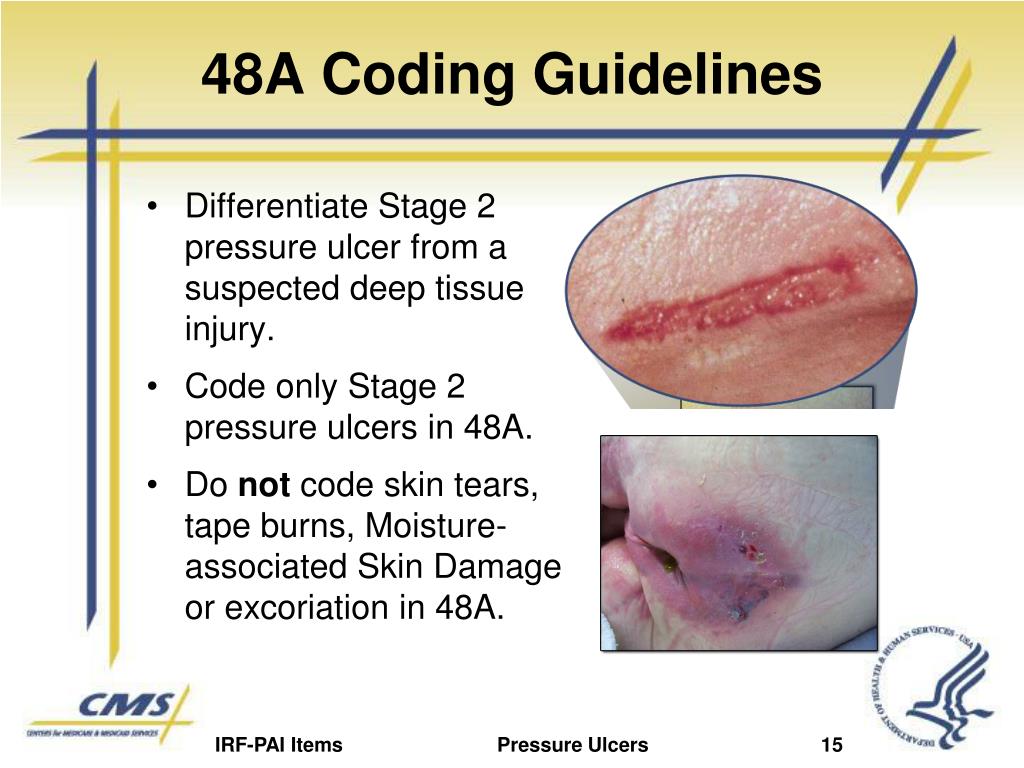 PPT IRFPAI Pressure Ulcer Items PowerPoint Presentation, free download ID1040265