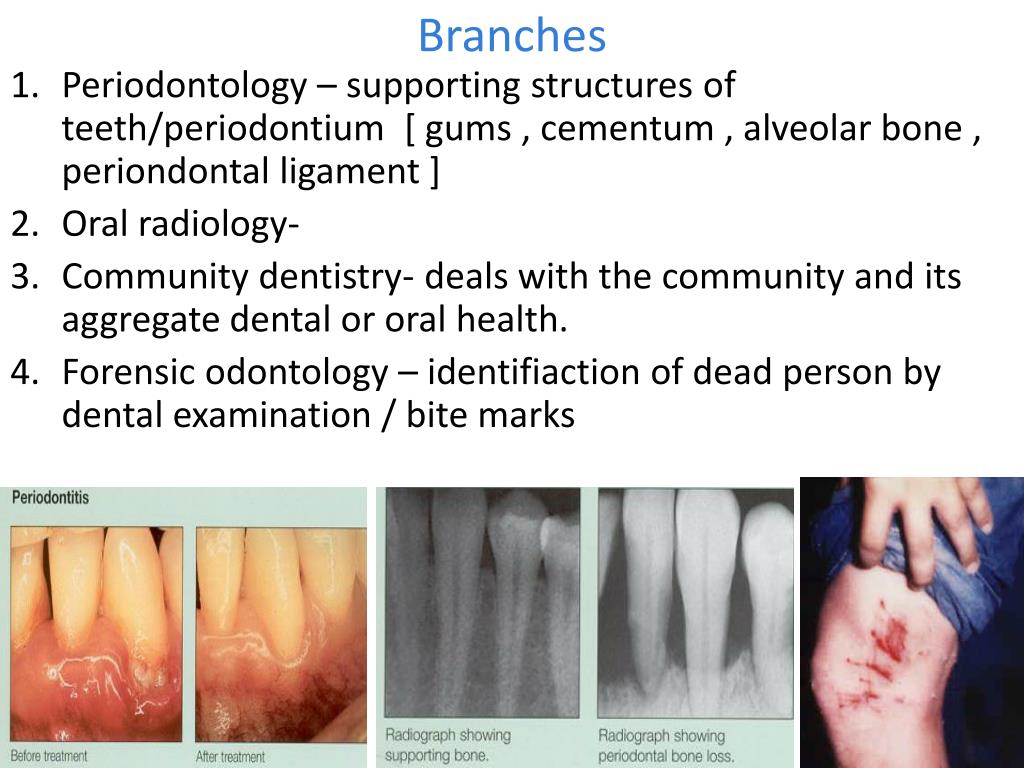 PPT Dentistry definition PowerPoint Presentation, free download ID1050430