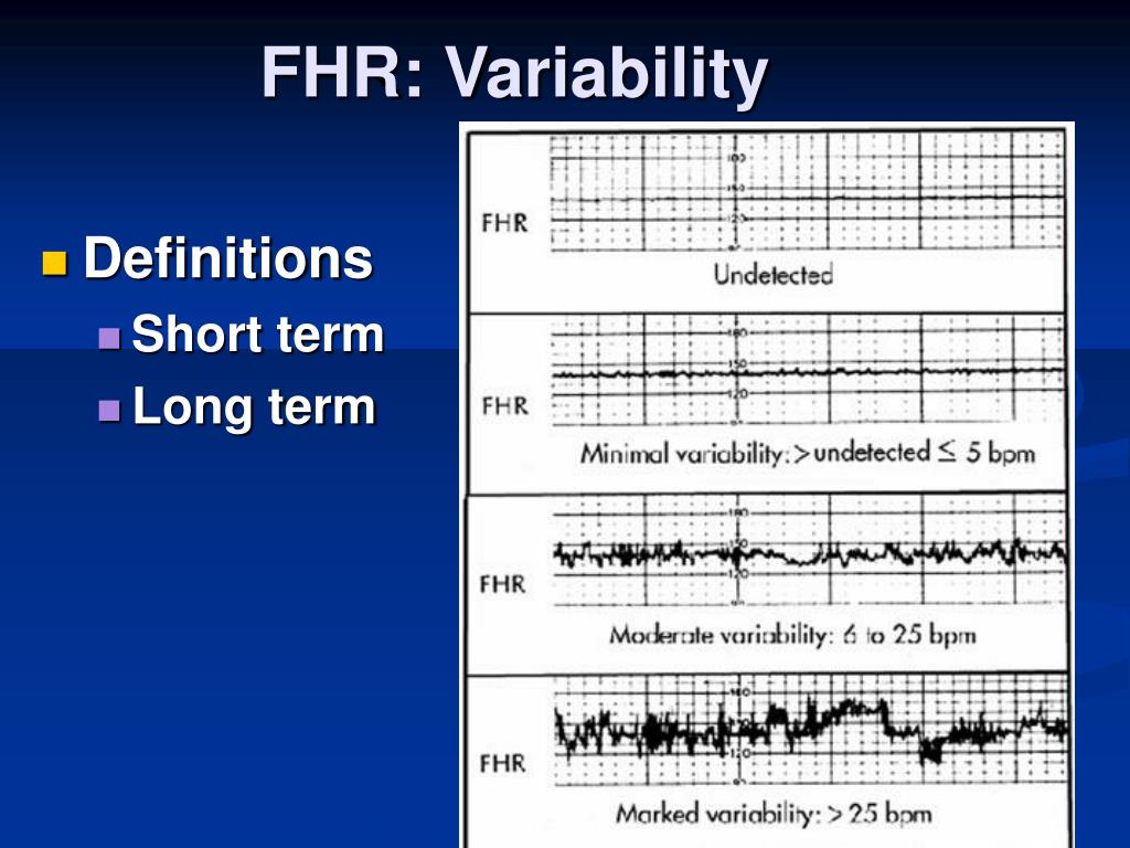 PPT - Cardiotocography ( CTG ) Electronic Fetal Monitoring PowerPoint