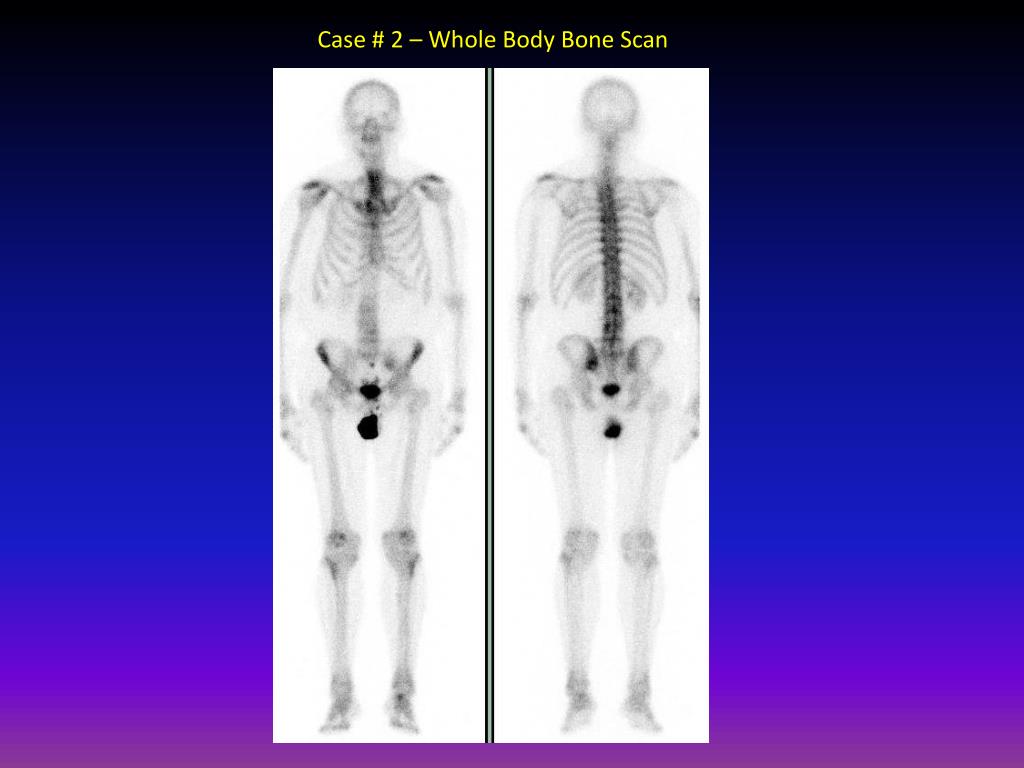 PPT Overview of SPECT/CT Applications PowerPoint
