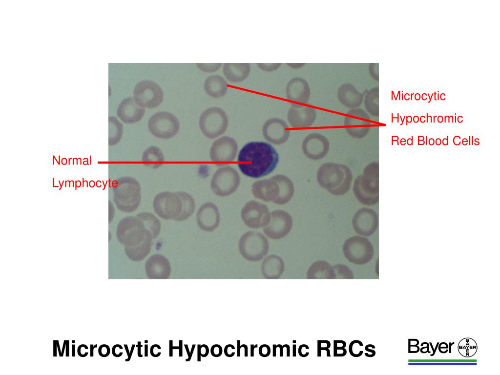 PPT ADVIA 120 CASE STUDIES PowerPoint Presentation, free download