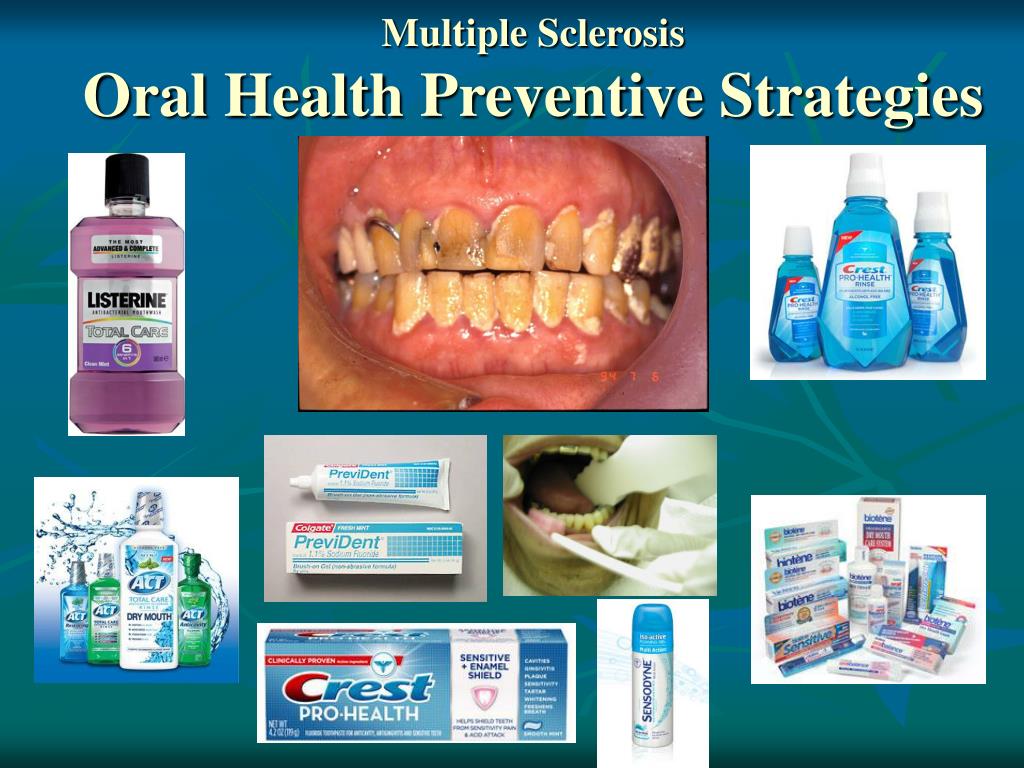 PPT Oral Health and Multiple Sclerosis PowerPoint Presentation, free download ID1071370