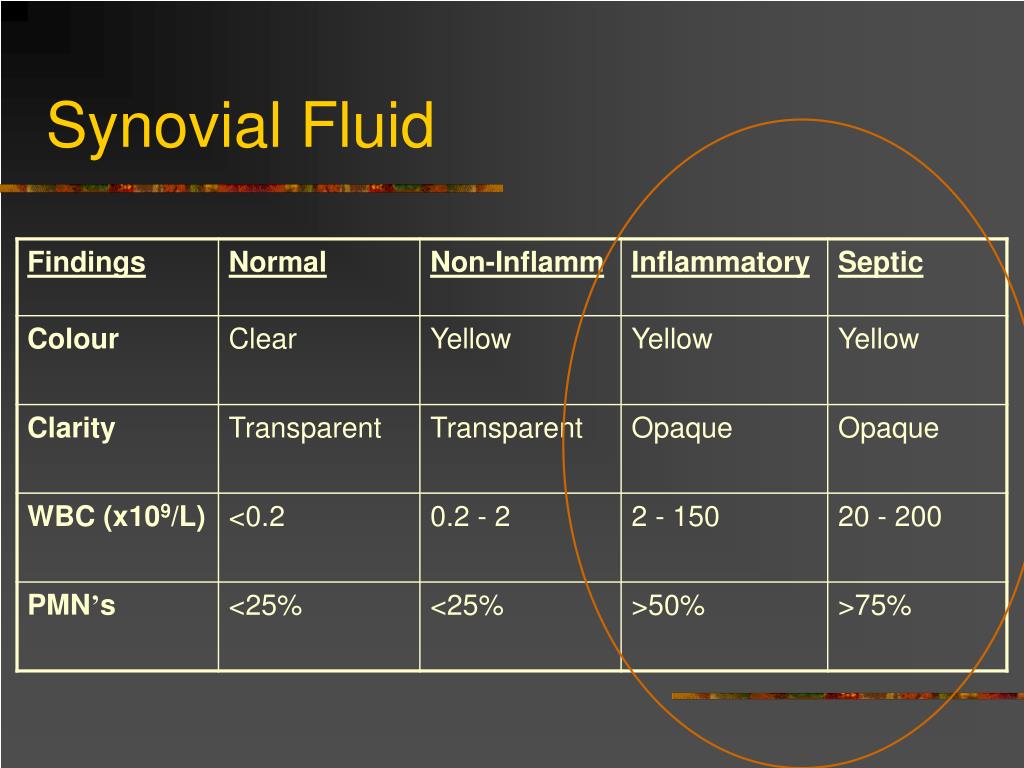 PPT Laboratory Rounds Is this a Septic Joint? PowerPoint Presentation