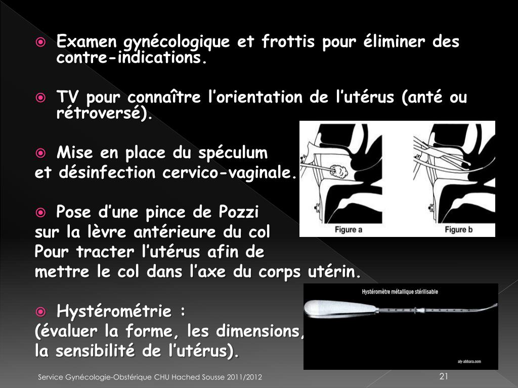 PPT La contraception par Dispositif IntraUtérin DIU