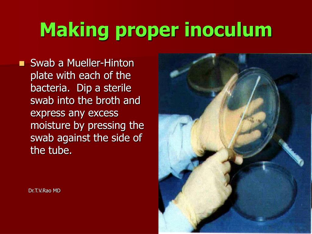 PPT Antibiotic Sensitivity Testing PowerPoint Presentation, free